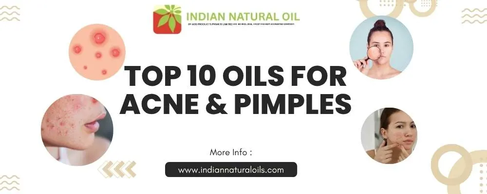 Top 10 Oils for Acne & Pimples